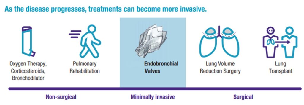 Disease progression - EBV